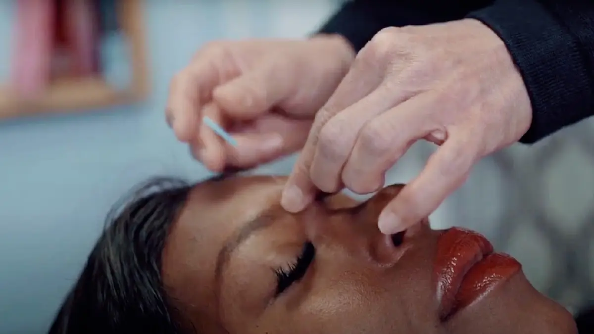 Acupuncture for Balanced Wellness — Acupuncture in W Jackson Blvd, Chicago