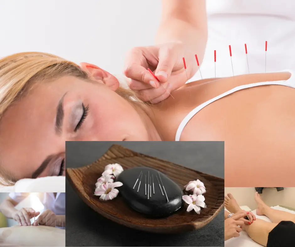 R.A. Acupuncture — Acupuncture in Park Ridge, Chicago