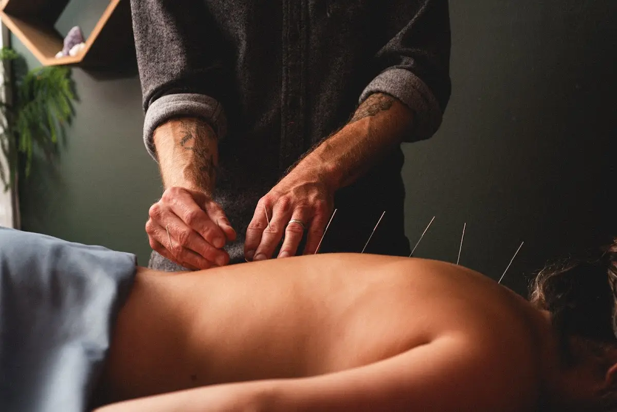 Upstream Medicine - Acupuncture & Herbs — Acupuncture in W Berteau Ave, Chicago