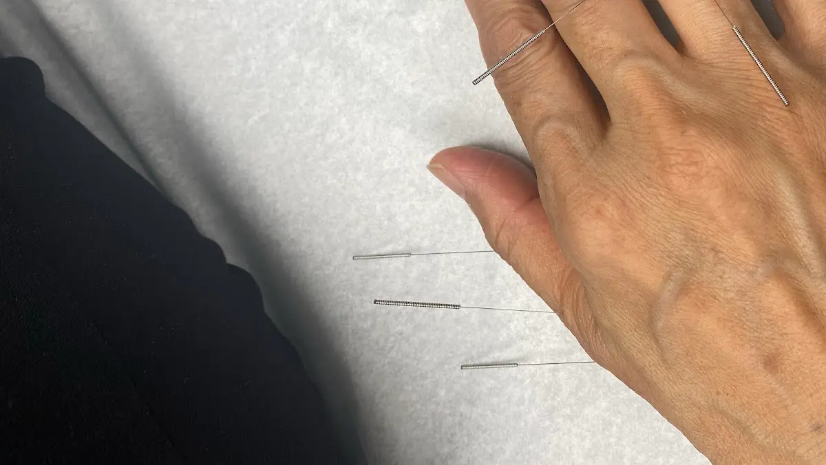 달라스 경희한의원 Dallas Kyung Hee Acupuncture & Oriental Medicine Clinic — Acupuncture in Lewisville, Dallas