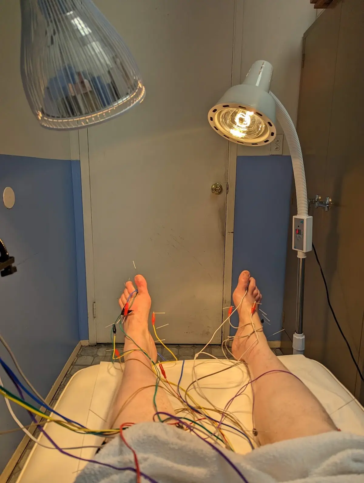 Acupuncture East Meets West — Acupuncture in N Hill St, Los Angeles