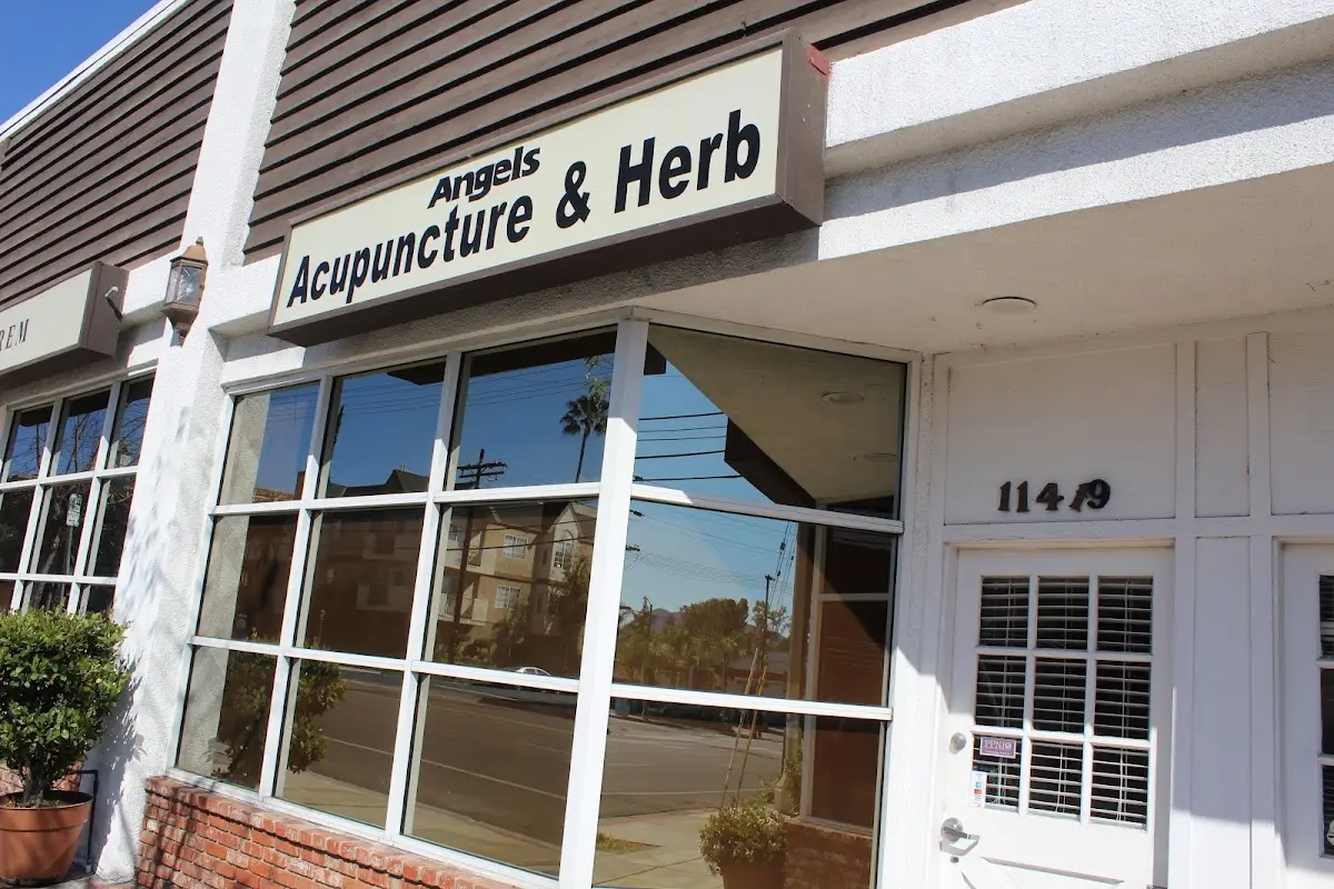 Angel's Acupuncture & Health Center — Acupuncture in Studio City, Los Angeles