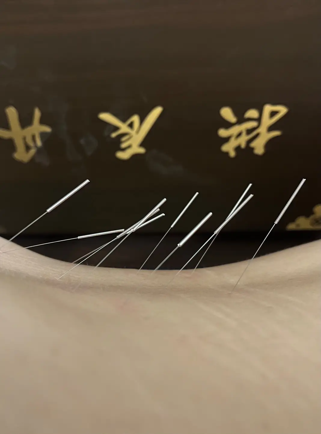 Han Acupuncture Health Center near Encino — Acupuncture in Encino, Los Angeles