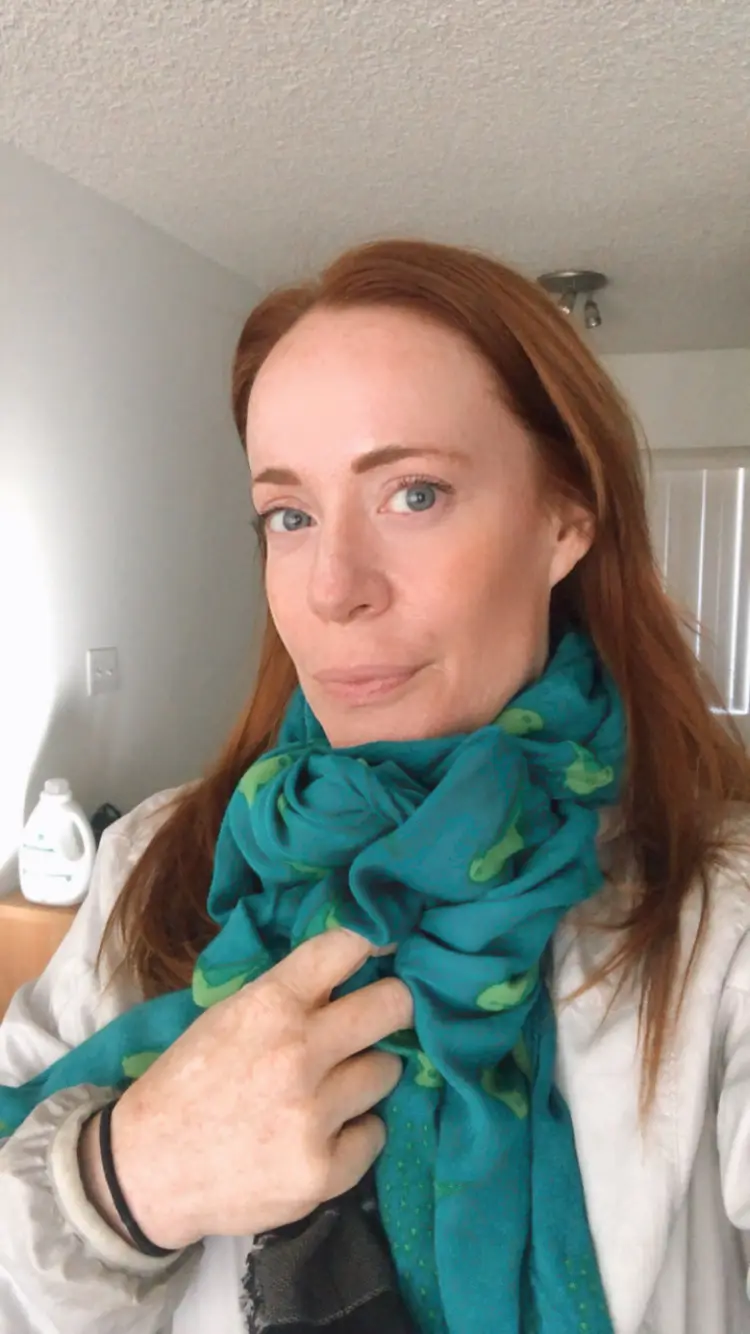 Katy Frame Acupuncture — Acupuncture in Forest Lawn Dr, Los Angeles