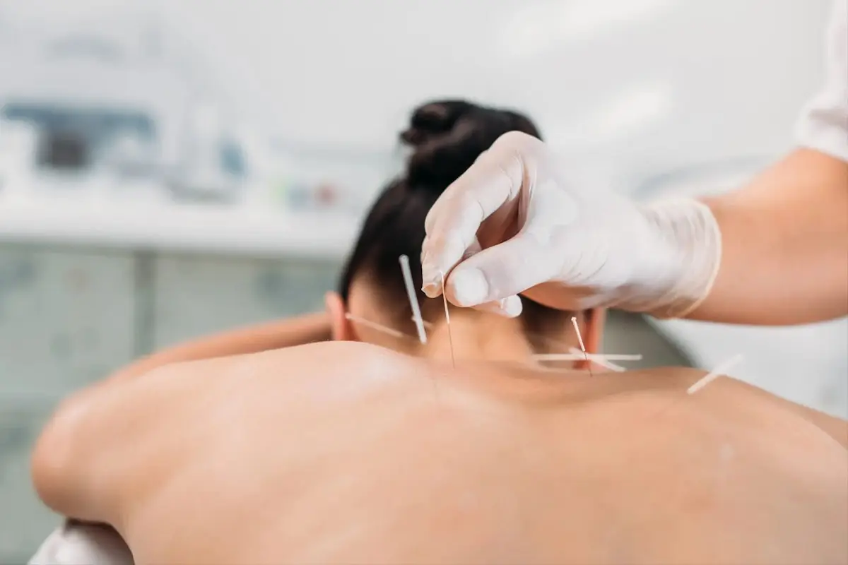 Ling's Acupuncture Clinic — Acupuncture in Gardena, Los Angeles