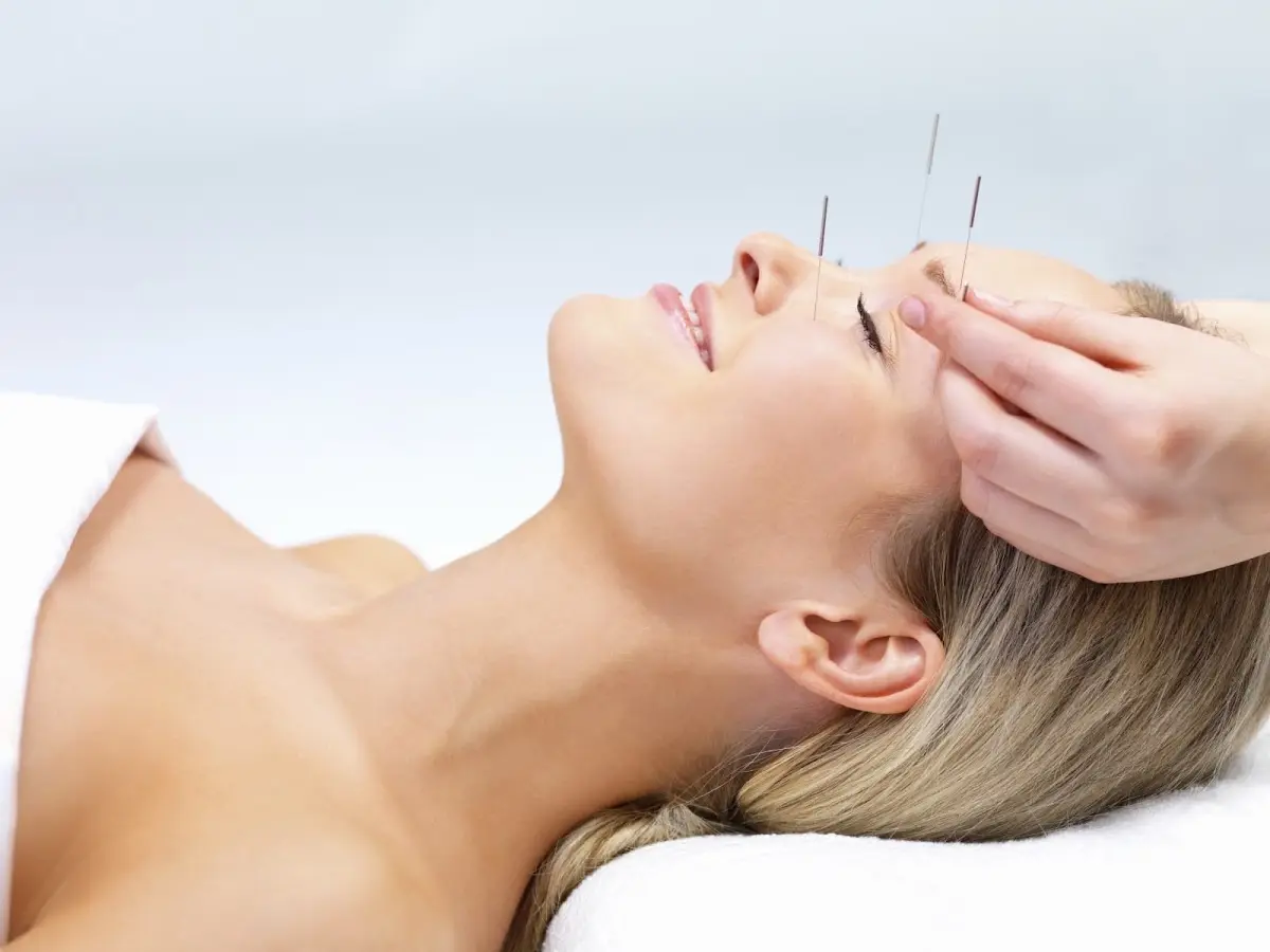 Shammah Acupuncture — Acupuncture in Long Beach, Los Angeles