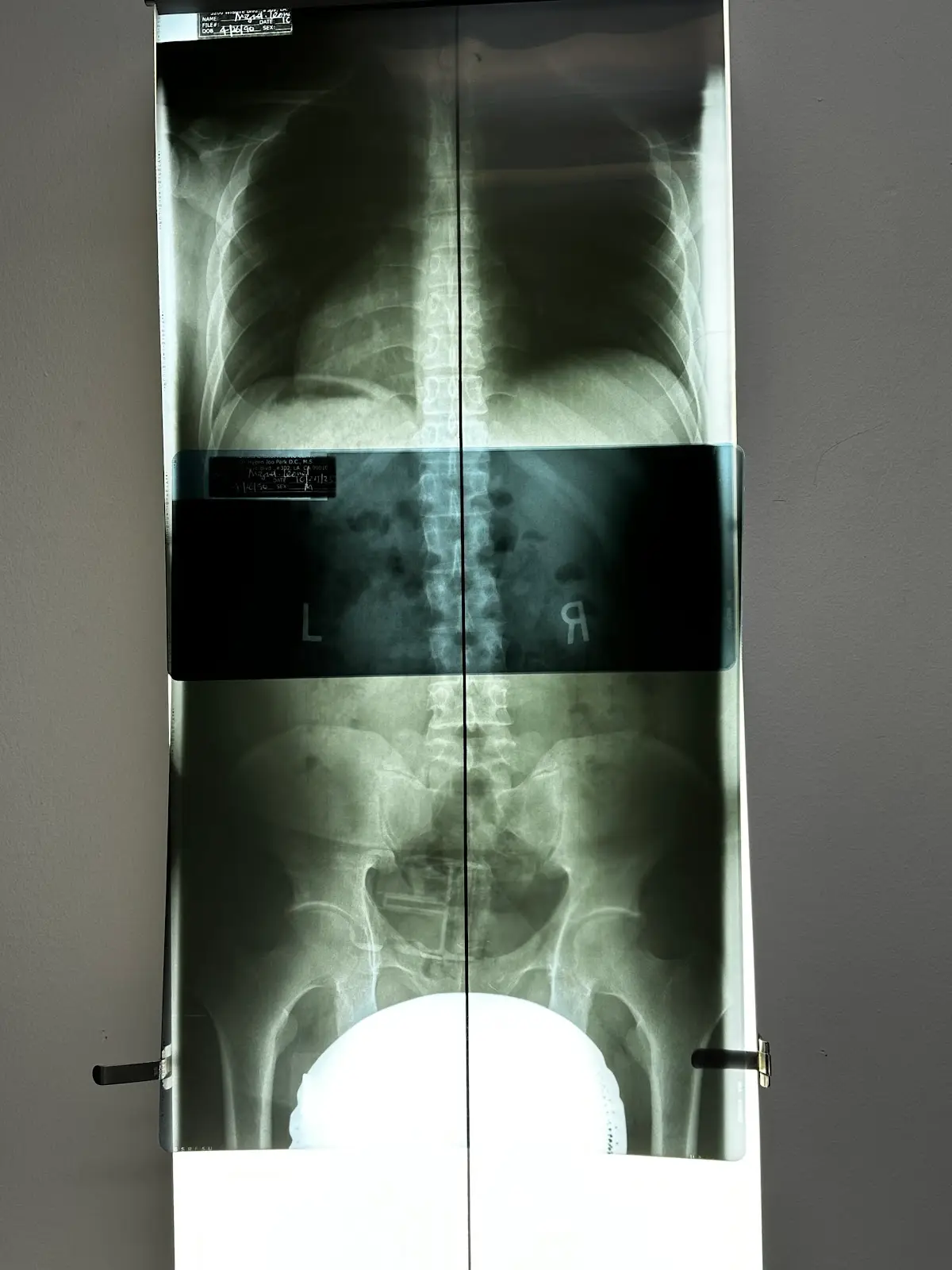 Yonsei Chiropractic Clinic — Chiropractic in Wilshire Blvd, Los Angeles