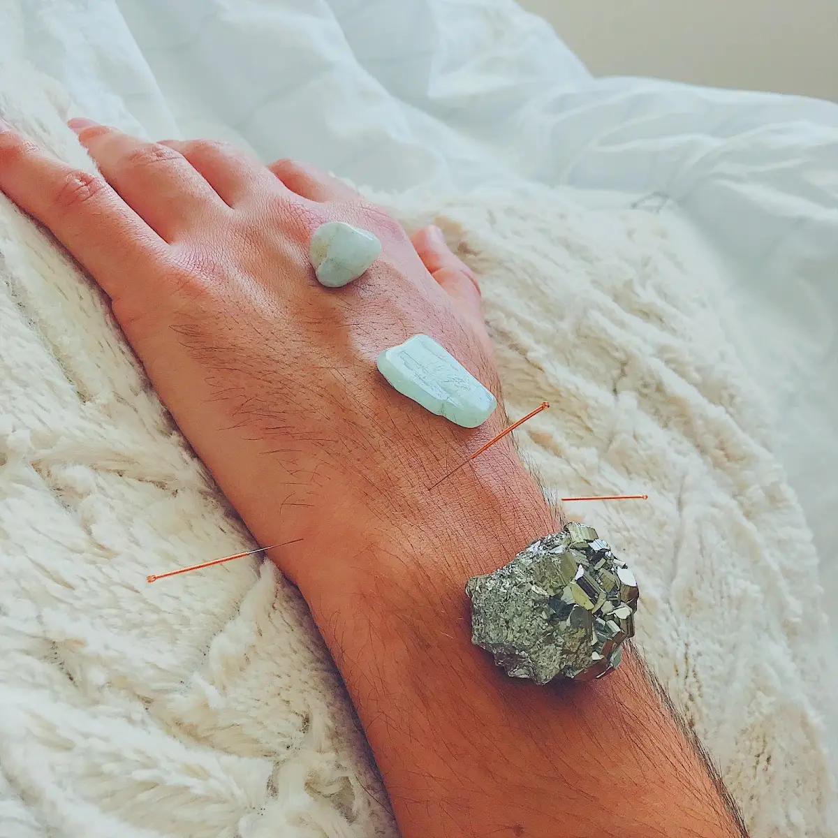 Aurapuncture — Acupuncture in Miami Beach, Miami