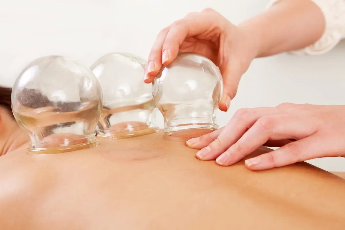 Miami Holistic Care — Acupuncture in NE 1st St, Miami