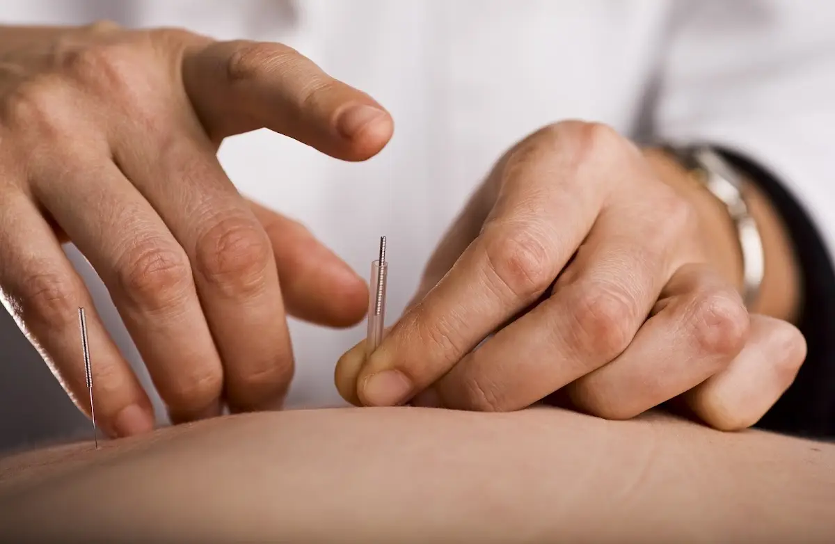 ACA Acupuncture & Wellness - Bayside — Acupuncture in -14 44th Ave Fl, New York