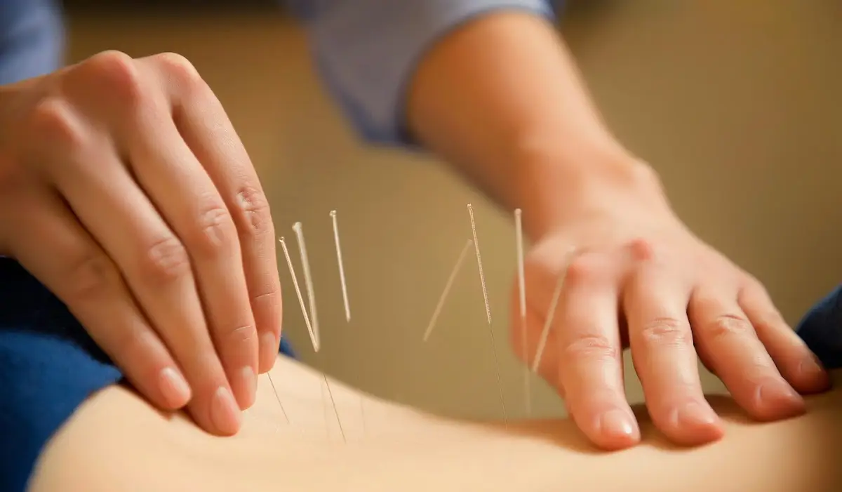 Acupuncture & Alternative Medicine of Staten Island — Acupuncture in Staten Island, New York