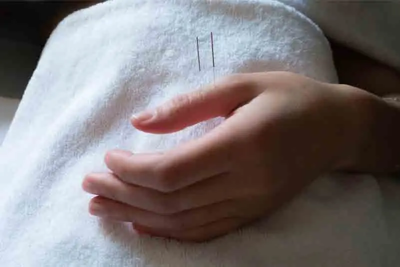 Acupuncture NYC / Medicine of Changes — Acupuncture in 5th Ave, New York