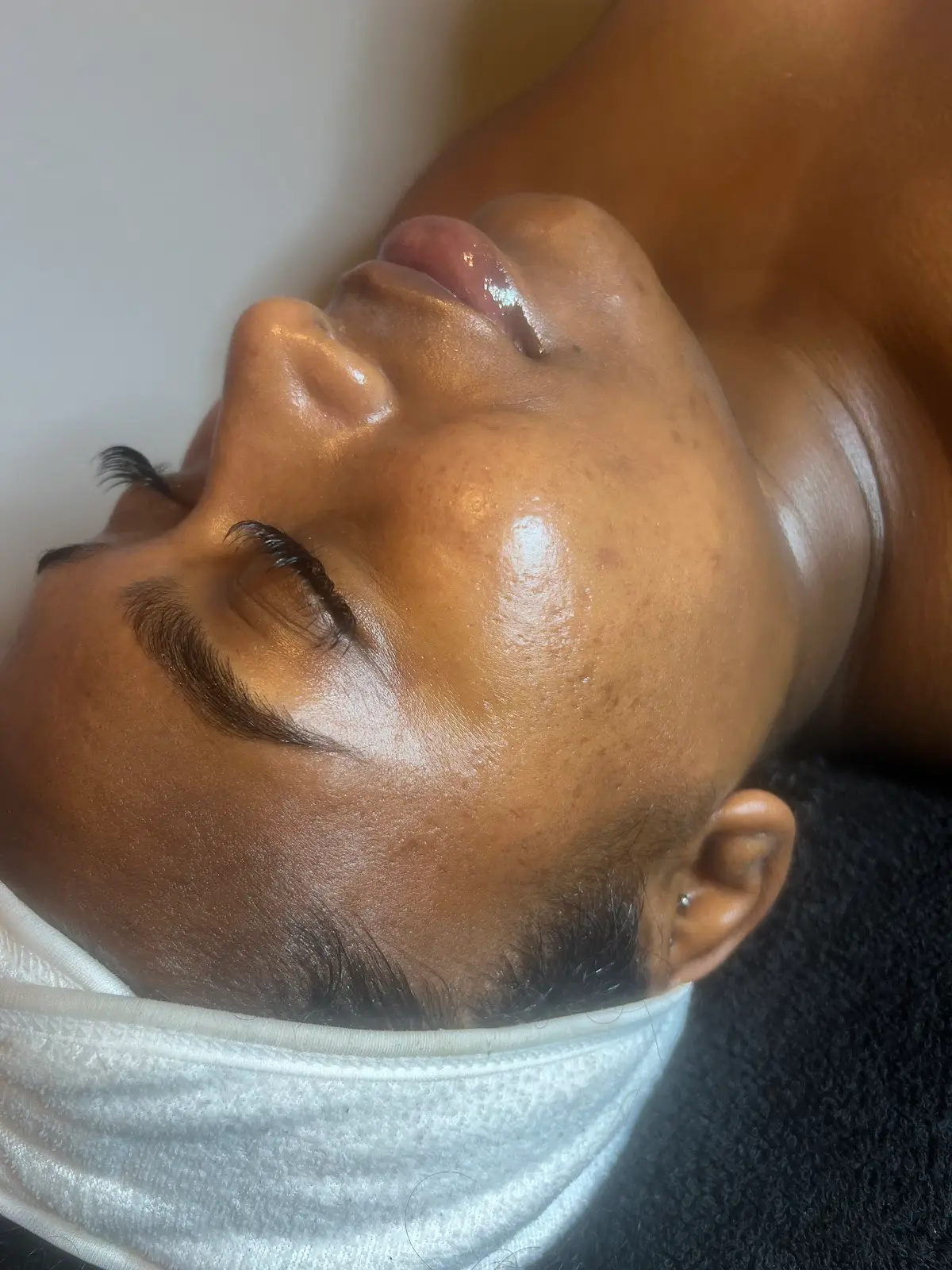 Dream Skin Aesthetics — Massage Therapy in Mott Ave, New York