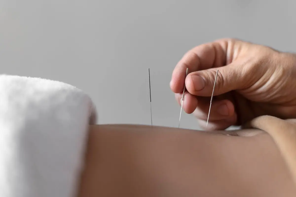 Jessica Liang Acupuncture PC — Acupuncture in Flushing, New York