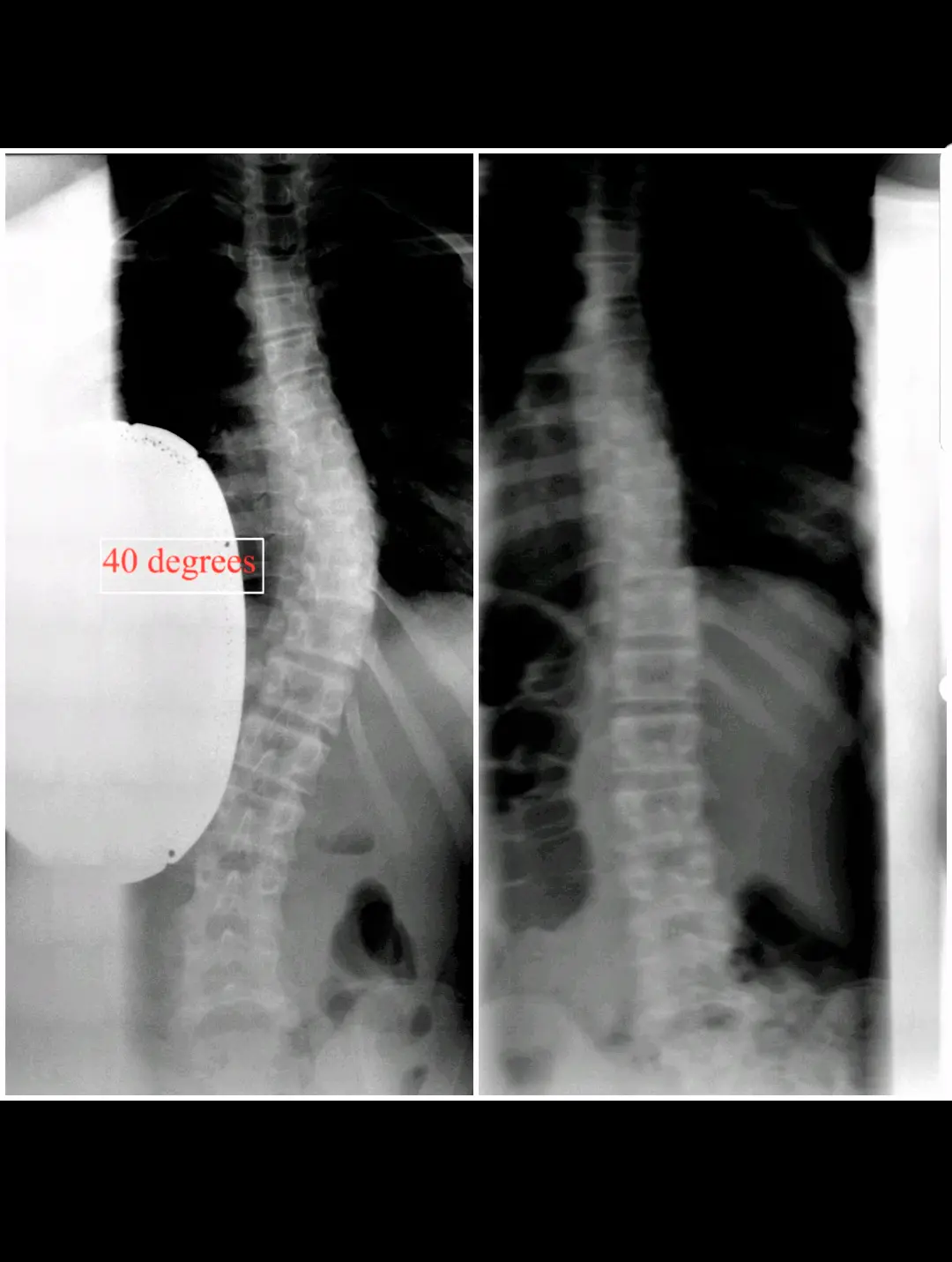 New York Chiropractic & Scoliosis Center — Chiropractic in Valley Stream, New York