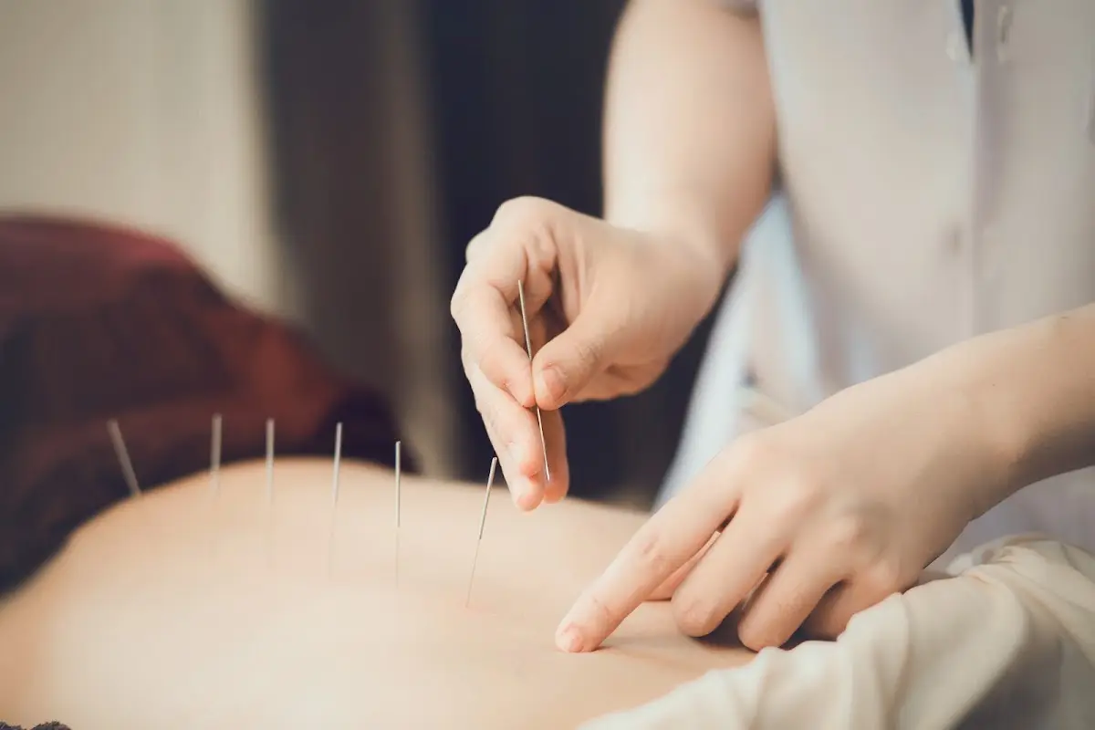 On Acupuncture — Acupuncture in -91 Bell Blvd Ste 205D, New York