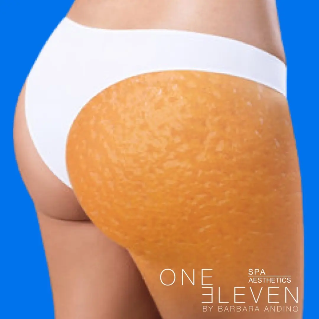 One Eleven Spa And Aesthetics — Massage Therapy in E Moonachie Rd, New York