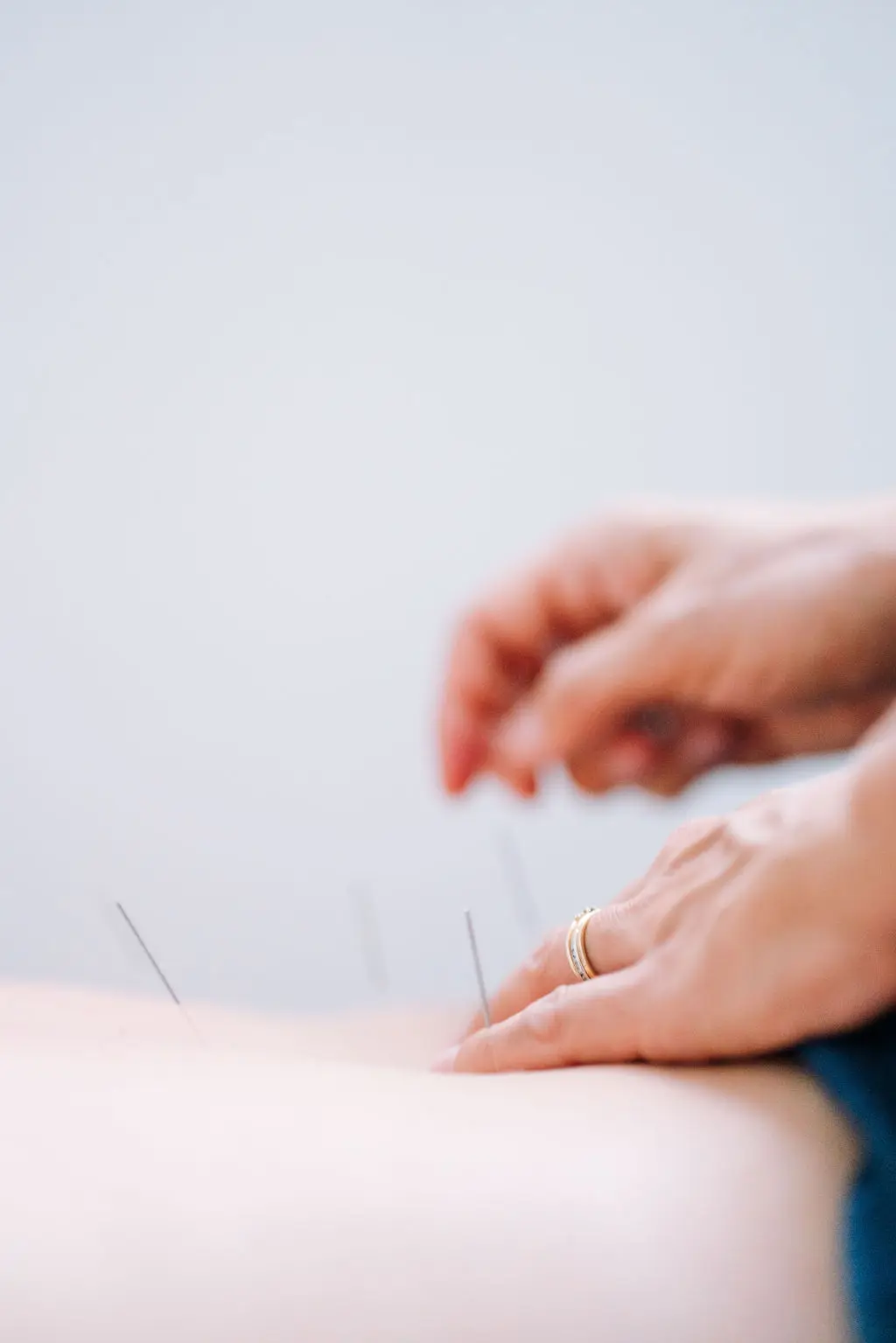 Samadhi Acupuncture — Acupuncture in Rockaway Park, New York