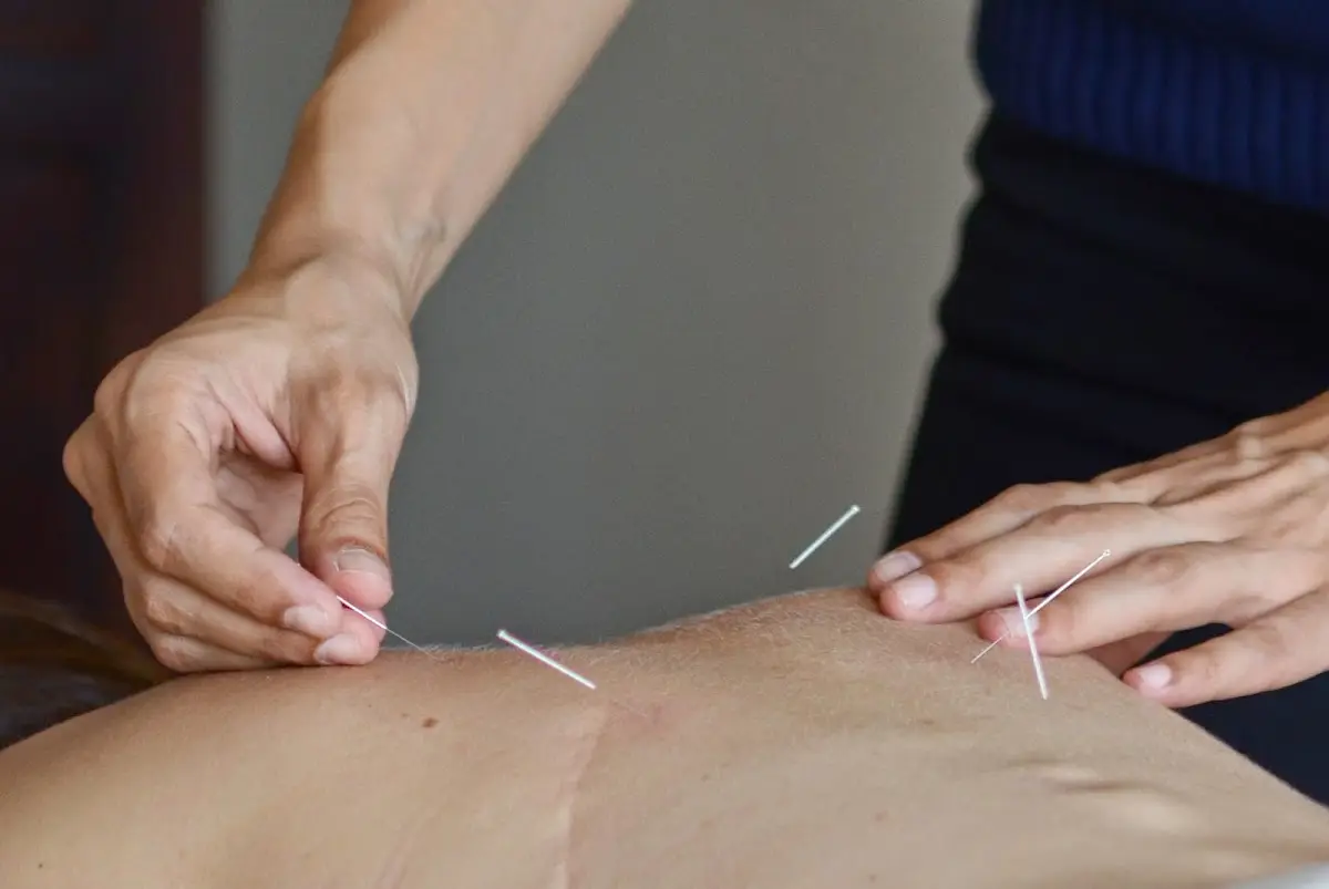 Slope Wellness — Acupuncture in 8th Ave Basement, New York