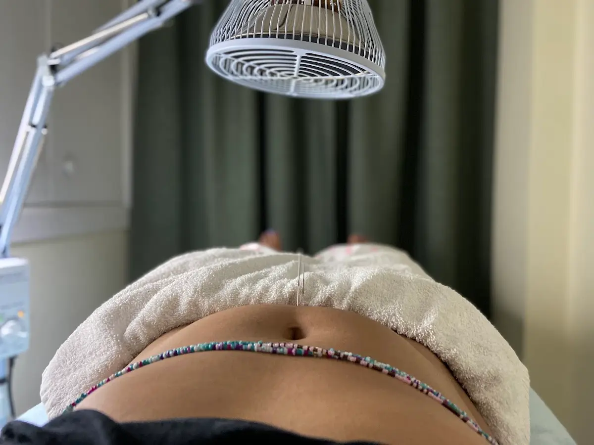 The Pathway Acupuncture — Acupuncture in Bayside, New York