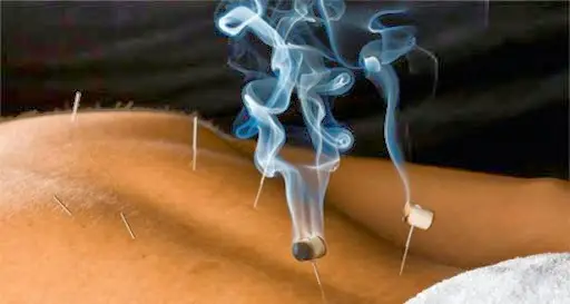 Blue Serenity Acupuncture — Acupuncture in E Bell Rd, Phoenix