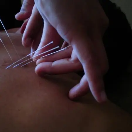HeART of Healing AZ, PLLC — Acupuncture in E Northern Ave, Phoenix