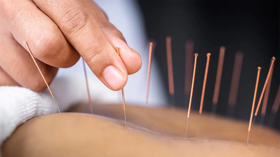 Nexte Integrated Health — Acupuncture in Scottsdale, Phoenix