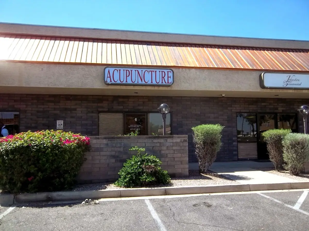 Shelton Acupuncture Clinic — Acupuncture in Glendale, Phoenix