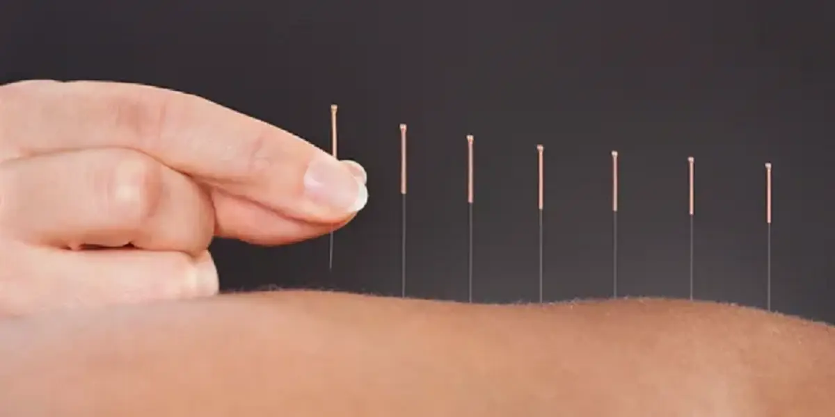 Acupuncture Healthcare Inc. — Acupuncture in World Trade Dr, San Diego