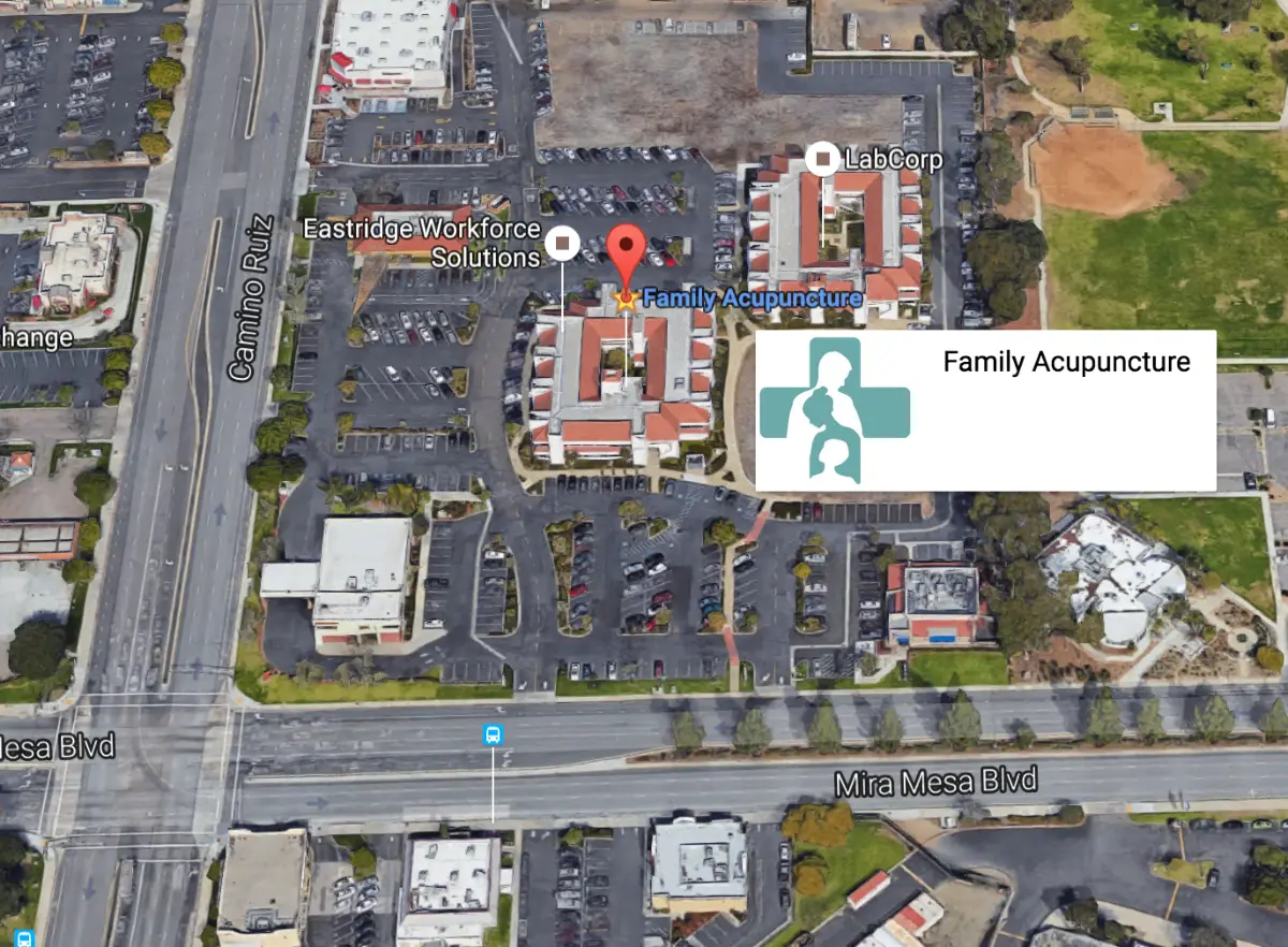 Family Acupuncture — Acupuncture in Camino Ruiz, San Diego
