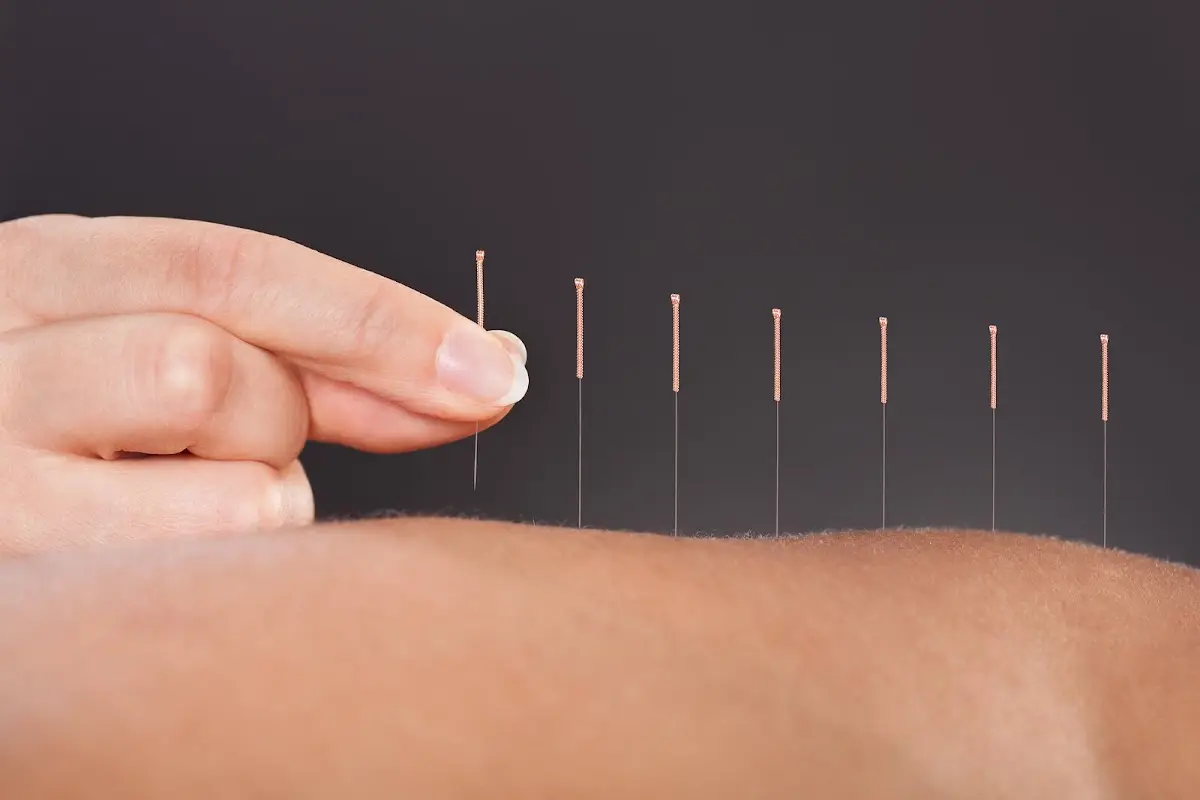 Healthy Star Acupuncture Center — Acupuncture in Bernardo Center Dr #209a, San Diego