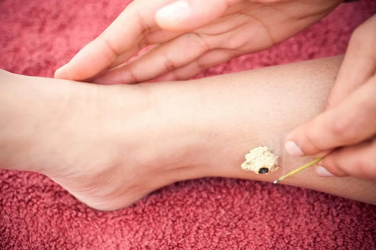 Tripat S Chawla, L. EAMP- Sangat Medicine — Acupuncture in 33rd Ave S c4, Seattle